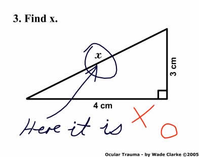 Find X